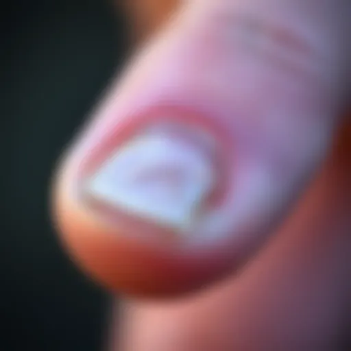 Close-up of a blister forming on a finger